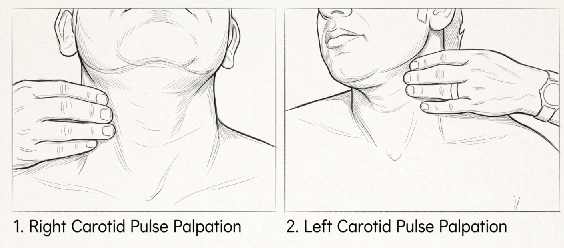 Carotid Artery Palpation