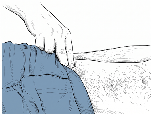 Palpating Femoral Pulse