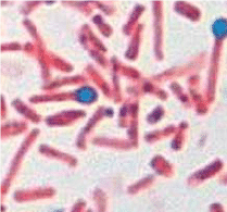 clostridium tetani under microscope